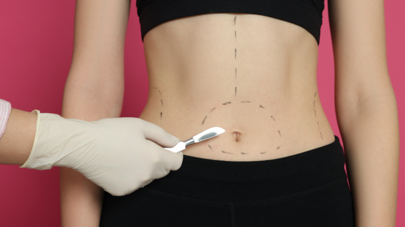 Dr. Haeckel Cabral detalha os conceitos da Lipo HD, o perfil ideal de pacientes e os limites técnicos do procedimento.